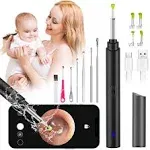 HaYiue Ear Wax Removal Tool Camera, Ear Cleaner with Camera, Ear Cleaning Kit 1296p HD Ear Scope, 6 LED Lights and 6 Ear Picks, Earwax Removal with Otoscope