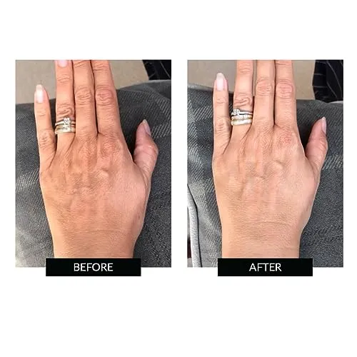 CurrentBody Skin LED Hand Perfector